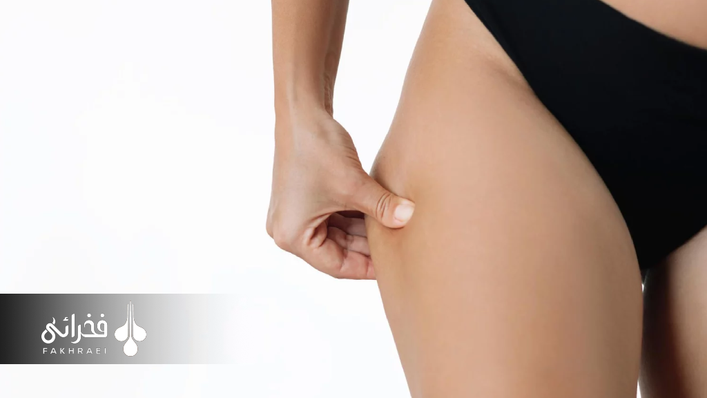 مزایاء تزریق فیلر هیپ دیپ