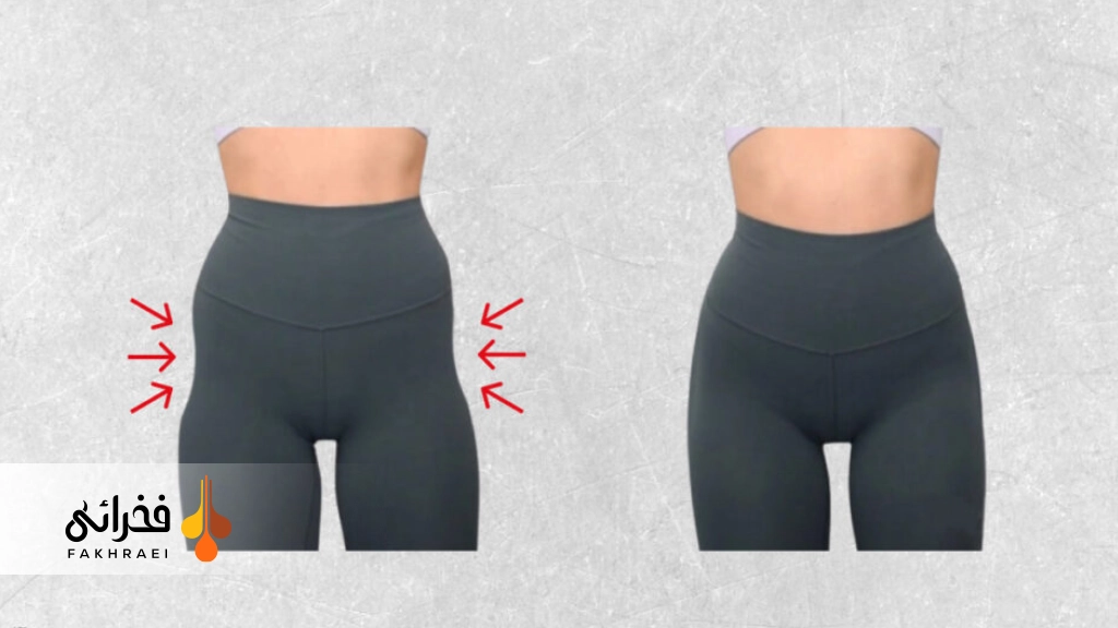 گودی کنار لگن یا هیپ دیپ چیست؟