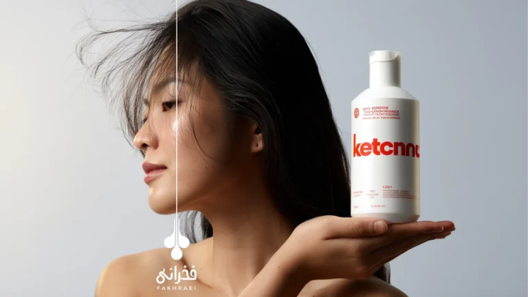 شامپو کتوکونازول برای ریزش مو