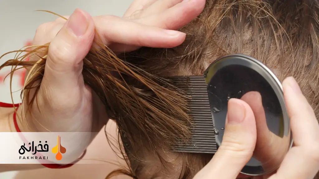 شانه‌کشی مرطوب برای درمان شپش سر