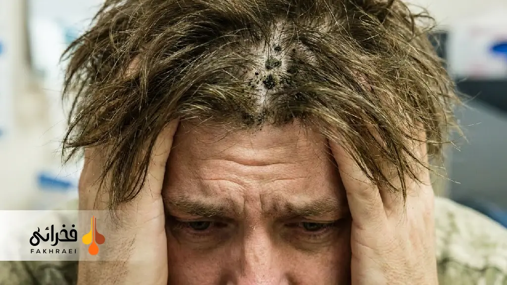 علل ایجاد قارچ سیاه