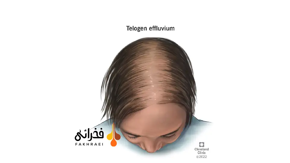 تلوژن افلوویوم چیست؟