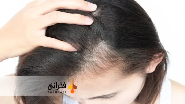 feature-fakhraei-1-1-19