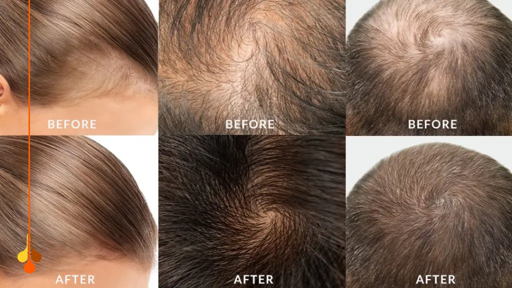 آمپول بیوتین بپانتن