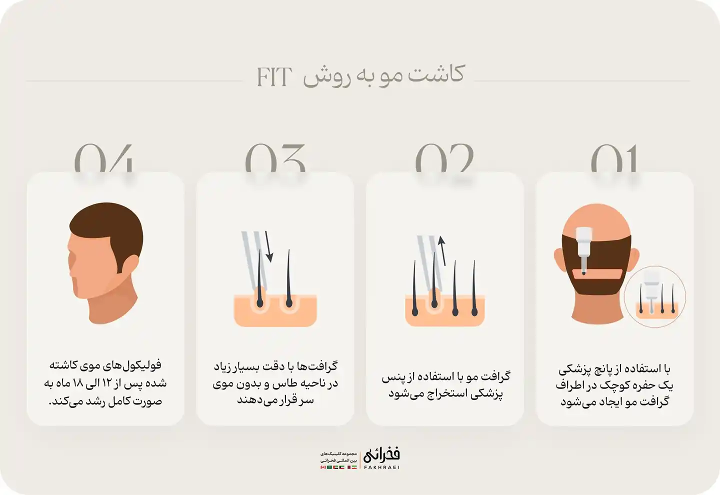 روش FIT کاشت مو