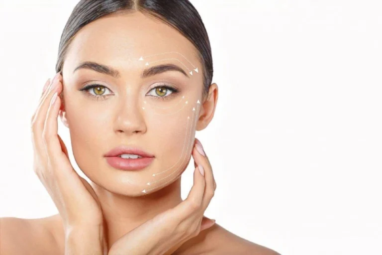 facelift