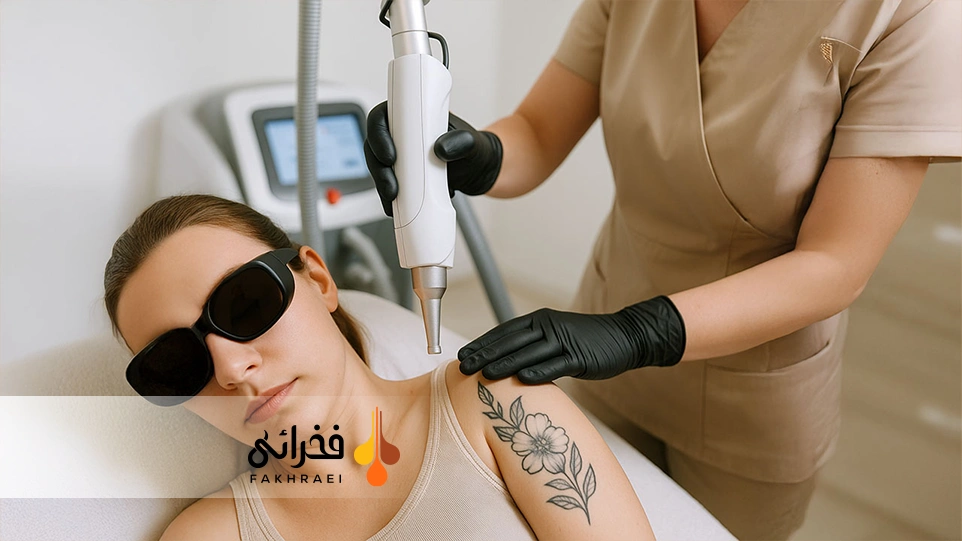 لیزر موهای زائد روی تتو