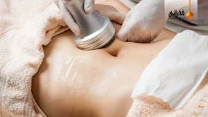 کویتیشن چیست