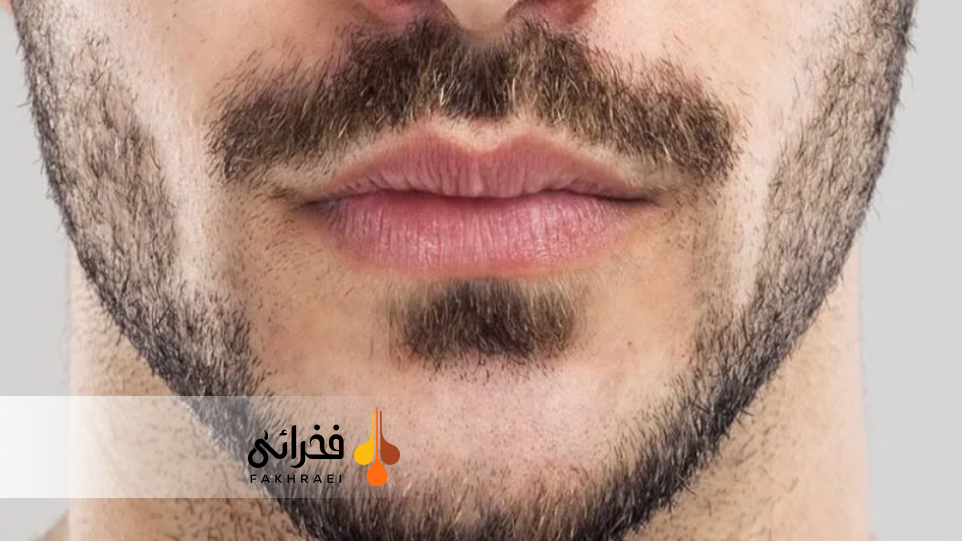  تفاوت ریش کم‌پشت با دیر رشد کردن ریش