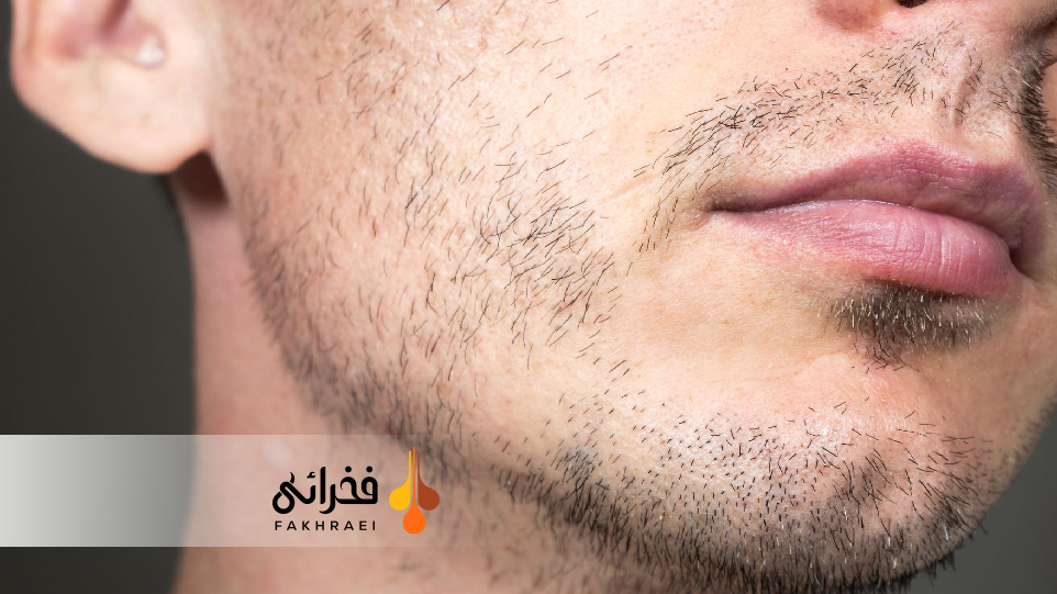 سن طبیعی درآمدن ریش چه زمانی است